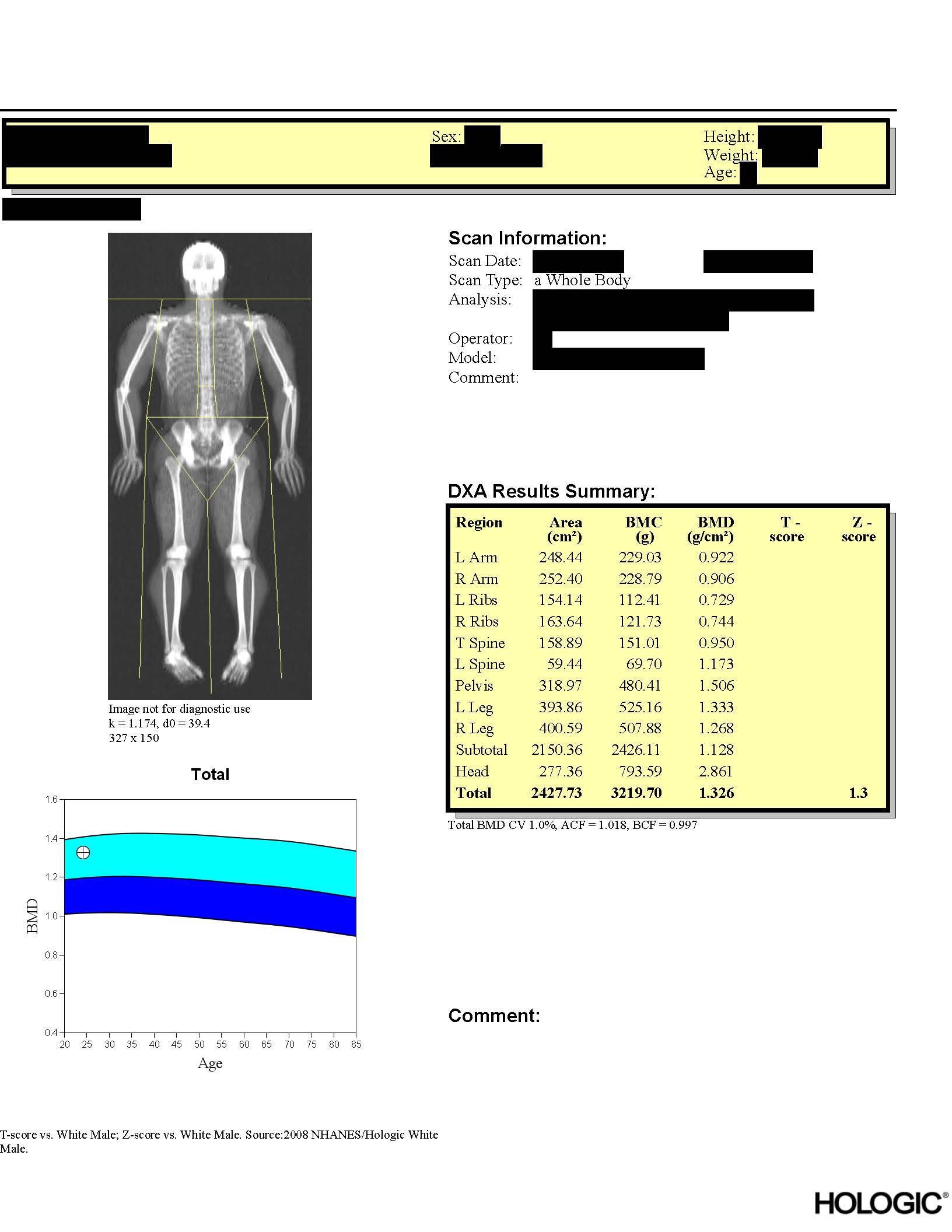 DXA report page 1