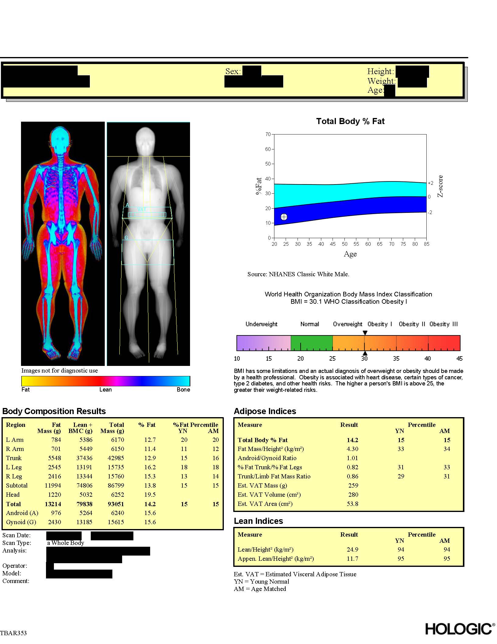 DXA report page 2